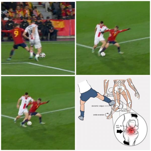 Официально: Гави не сыграет в этом сезоне