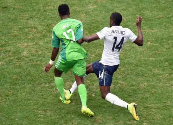 У Онази не двойной перелом, а сильный ушиб?