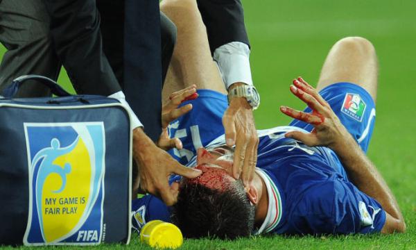 ФИФА может разрешить приостанавливать матч на 3 минуты из-за травм головы