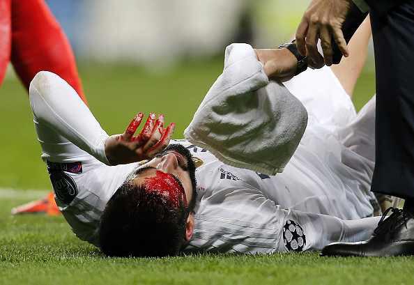 Иско: «Четыре раза менял футболку по ходу матча. Потерял много крови»